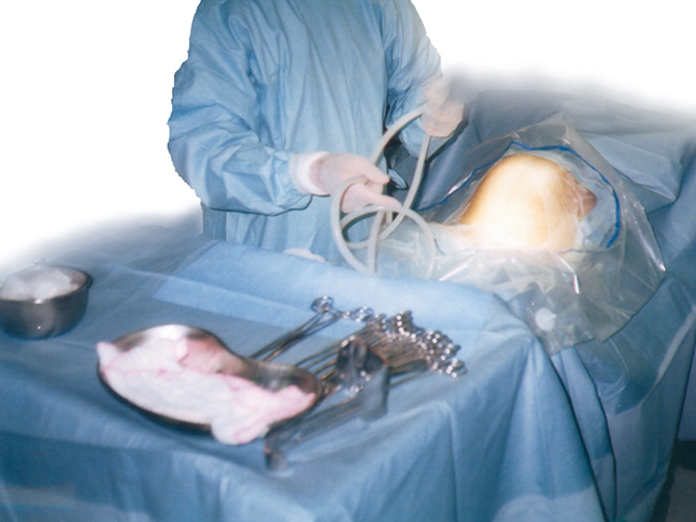 BioCover Disposable Surgical Drapes