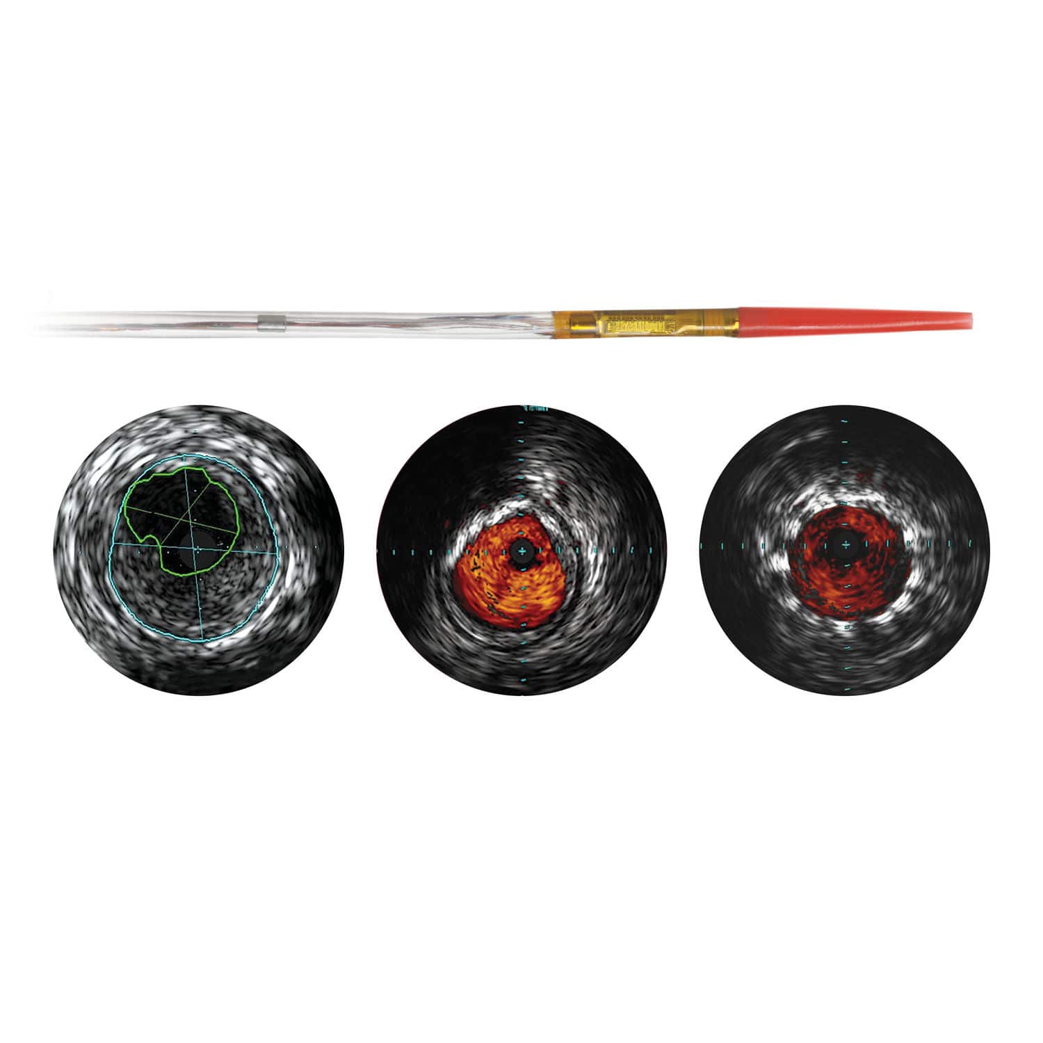 Eagle Eye Platinum Digital IVUS Catheter